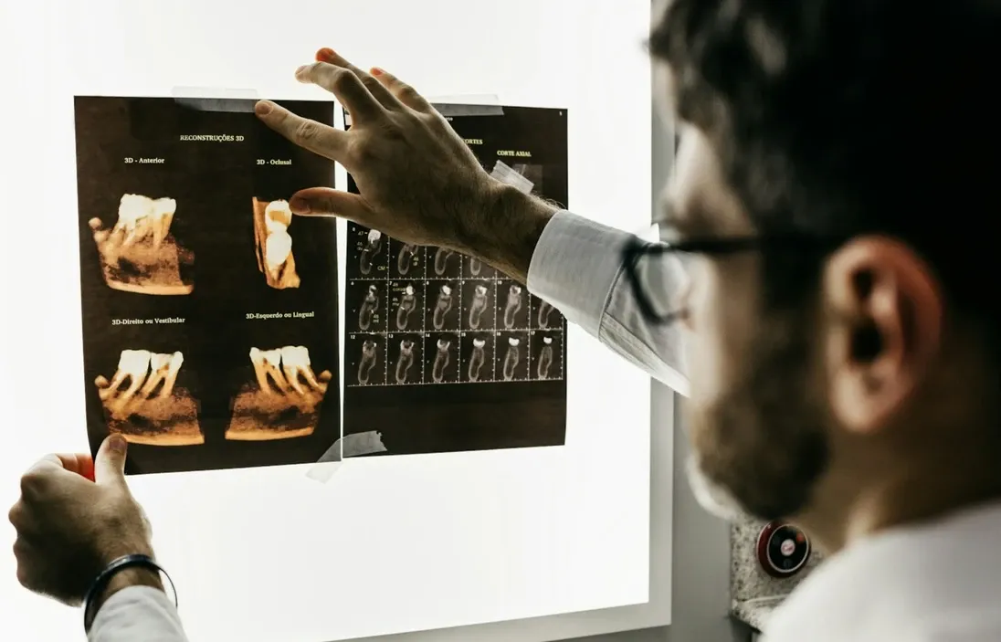Specjalista analizuje trójwymiarową tomografię CBCT zębów przed zabiegiem POVER Endo