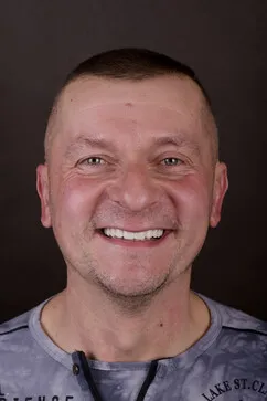 Naturalny uśmiech pacjenta EndoEstetica Clinic po zakończonej terapii, portret 3 z 8
